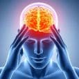 Migraine treatment