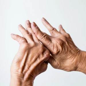 Psoriatic Arthritis treatment