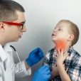 Tonsillitis image 2